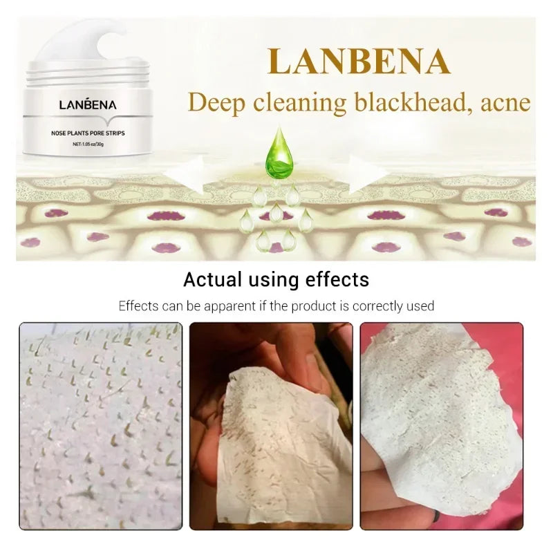 LANBENA Blackhead Remover Nose Mask Pore Strip Black Mask Peeling Treatment Face Deep Cleansing Skin Care Korea Cosmetics