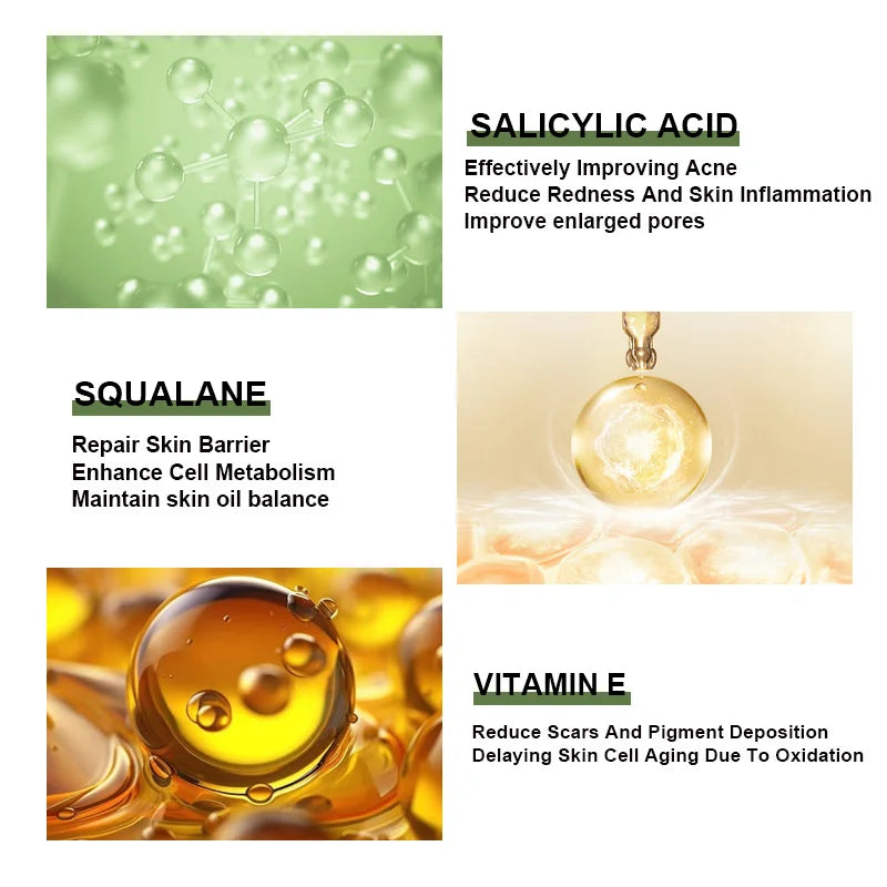 Acne Removing Serum Squalane Shrink Pores Facial Essence Vitamin E Moisturizing Skincare Products